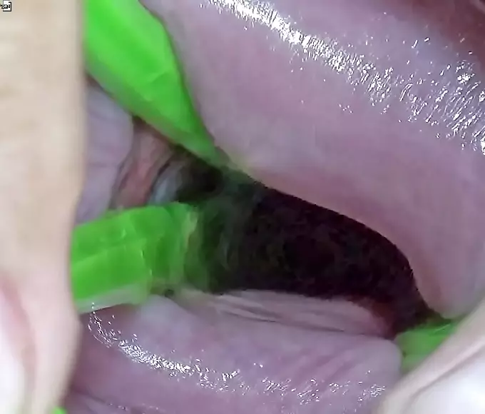 np Sizzling Japanese MILF Nurse Receives Intense Doctor's Pleasure